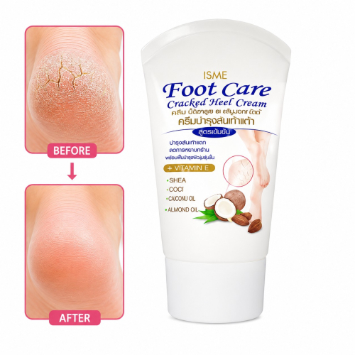 Crème Réparatrice pour Talons Crevassés ISME Rasyan à la Vitamine E, au Beurre de Karité, à l’Huile de Coco et à l’Huile d’Amande, 80 g