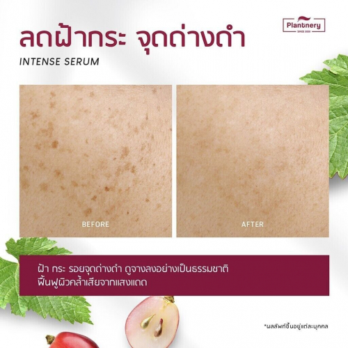 Сыворотка для лица Plantnery Anti-Melasma на основе виноградных косточек, 30 мл